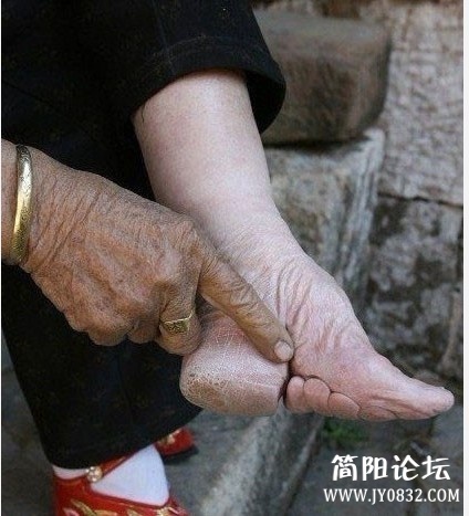 旧社会下的牺牲品——三寸金莲！！震惊了！！！！！！！！看着都痛.jpg